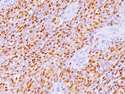 Biocare Medical, LLC Myogenin Antibody - Concentrate, 0.1 ml, Quantity: