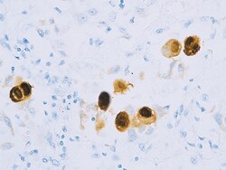 Biocare Medical, LLC Cytomegalovirus (CMV) Antibody - Concentrate, 1.0