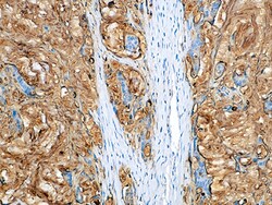 Biocare Medical, LLC CA 19-9 Antibody - Concentrate, 0.1 ml, Quantity: