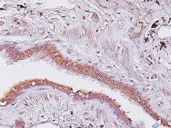 Biocare Medical, LLC Amyloid A Antibody - Concentrate, 0.1 ml, Quantity: