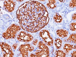 Biocare Medical, LLC CD10 Antibody - Concentrate, 0.1 ml, Quantity: Each