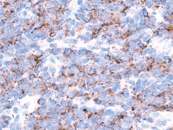 Biocare Medical, LLC TIA-1 Antibody - Concentrate, 0.5 ml, Quantity: Each