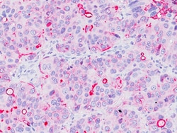 Biocare Medical, LLC Epithelial Membrane Antigen (EMA [Mc-5]) Antibody