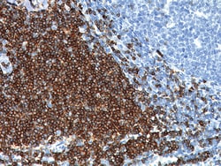 Biocare Medical, LLC CD7 Antibody - Concentrate, 1.0 ml, Quantity: Each