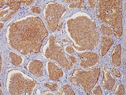 Biocare Medical, LLC CD56 Antibody - Concentrate, 1.0 ml, Quantity: Each