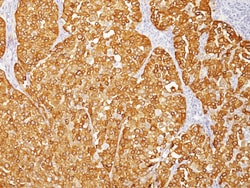 Biocare Medical, LLC&nbsp;HMB45+MART-1+TYROSINASE 0.5ML