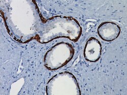 Biocare Medical, LLC Cytokeratin 5 Antibody - Concentrate, 0.1 ml, Quantity: