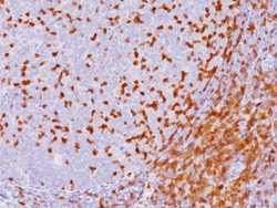 Biocare Medical, LLC ZAP-70 Antibody - Concentrate, 0.1 ml, Quantity: Each