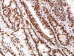 Biocare Medical, LLC MSH6 Antibody - Concentrate, 0.5 ml, Quantity: Each