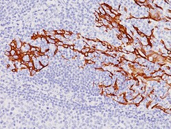 Biocare Medical, LLC CD19 Antibody - Concentrate, 0.1 ml, Quantity: Each