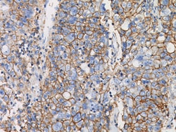 Biocare Medical, LLC CD44 (HCAM) Antibody - Concentrate, 0.1 ml, Quantity: