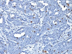 Biocare Medical, LLC BRCA-1 Antibody - Concentrate, 0.1 ml, Quantity: Each