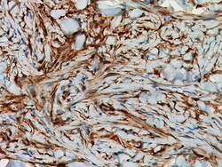 Biocare Medical, LLC Factor XIIIa Antibody - Concentrate, 0.1 ml, Quantity: