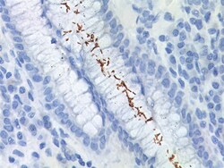 Biocare Medical, LLC Helicobacter pylori Antibody - Concentrate, 0.1 ml,