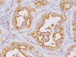 Biocare Medical, LLC Napsin A Antibody - Concentrate, 0.1 ml, Quantity: