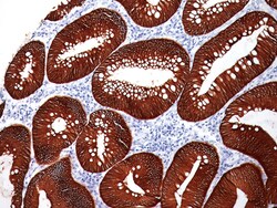 Biocare Medical, LLC MOC-31 Antibody - Concentrate, 0.1 ml, Quantity: Each