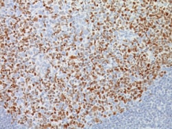 Biocare Medical, LLC Bcl-6 [LN22] Antibody - Concentrate, 1.0 ml, Quantity: