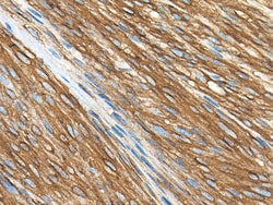 Biocare Medical, LLC CD117/c-kit Antibody - Concentrate, 1.0 ml, Quantity: