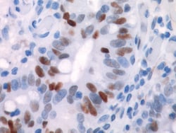 Biocare Medical, LLC p53 Antibody - Concentrate, 0.1 ml, Quantity: Each