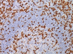 Biocare Medical, LLC CD3 Antibody - Concentrate, 0.1 ml, Quantity: Each