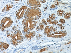 Biocare Medical, LLC Prostate Specific Antigen Antibody - Concentrate,