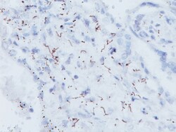 Biocare Medical, LLC Treponema Pallidum Antibody - Concentrate, 0.5 ml,