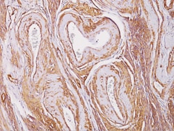 Biocare Medical, LLC Mycobacterium tuberculosis Antibody - Concentrate,
