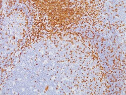 Biocare Medical, LLC CD3 Antibody - Concentrate, 0.1 ml, Quantity: Each