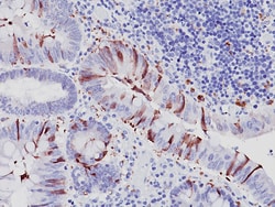 Biocare Medical, LLC Caspase-3 Antibody - Concentrate, 0.5 ml, Quantity: