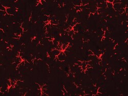 Biocare Medical, LLC Microglia Antibody - Concentrate, 0.5 ml, Quantity: