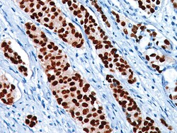 Biocare Medical, LLC Progesterone Receptor (PR) [SP2] Antibody - Concentrate,