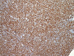 Biocare Medical, LLC Cyclin D1 Rabbit Antibody - Concentrate, 0.5 ml, Quantity: