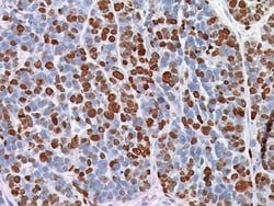 Biocare Medical, LLC Ki-67 (R) Antibody - Concentrate, 0.5 ml, Quantity: