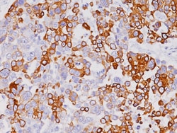 Biocare Medical, LLC Cytokeratin 7 Antibody - Concentrate, 1.0 ml, Quantity: