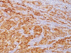 Biocare Medical, LLC Placental Alkaline Phosphatase Antibody - Concentrate,