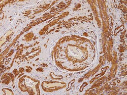 Biocare Medical, LLC Smooth Muscle Actin Antibody - Predilute, 6.0 ml,