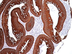Biocare Medical, LLC Pan Cytokeratin [AE1/AE3] Antibody - Predilute, 6.0