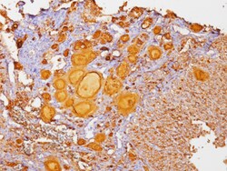 Biocare Medical, LLC Thyroglobulin Cocktail Antibody - Predilute, 6.0 ml,