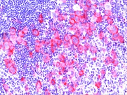 Biocare Medical, LLC CD30 Antibody - Predilute, 6.0 ml, Quantity: Each
