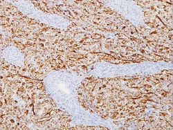 Biocare Medical, LLC Desmin Antibody - Predilute, 6.0 ml, Quantity: Each