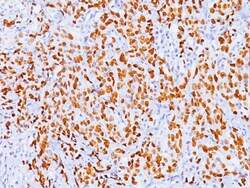 Biocare Medical, LLC p53 Tumor Suppressor Protein Antibody - Predilute,