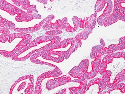 Biocare Medical, LLC Pan Cytokeratin [Lu-5] Antibody - Predilute, 6.0 ml,