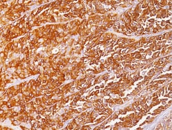 Biocare Medical, LLC HMB45 Antibody - Predilute, 6.0 ml, Quantity: Each