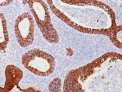 Biocare Medical, LLC Cytokeratin 20 Antibody - Predilute, 6.0 ml, Quantity: