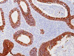 Biocare Medical, LLC Cytokeratin 20 Antibody - Predilute, 25 ml, Quantity: