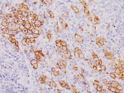 Biocare Medical, LLC CD30 Cocktail Antibody - Predilute, 6.0 ml, Quantity: