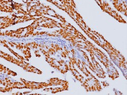 Biocare Medical, LLC Estrogen Receptor (ER) [6F11] Antibody - Predilute,