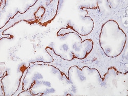 Biocare Medical, LLC Cytokeratin 5/6 Antibody - Predilute, 6.0 ml, Quantity: