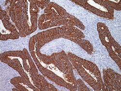 Biocare Medical, LLC Ber-EP4 Antibody - Predilute, 6.0 ml, Quantity: Each