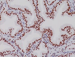 Biocare Medical, LLC Androgen Receptor Antibody - Predilute, 6.0 ml, Quantity: